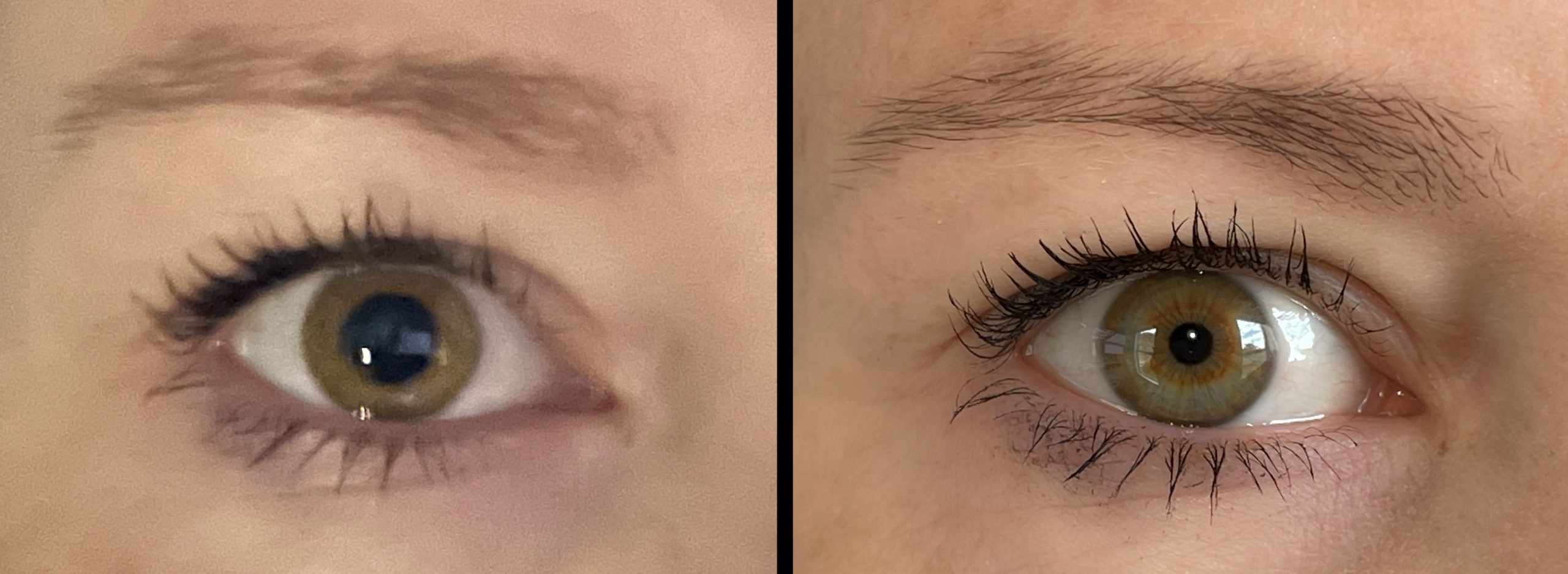 Eye photographed in dim and bright light to show change in pupil size.